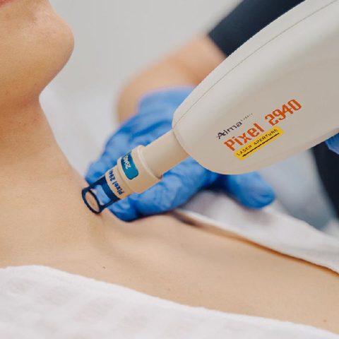 Φακίδες και θεραπείες