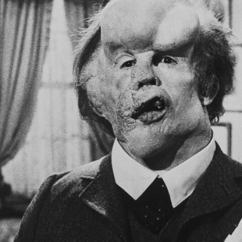 Επανέκδοση της ταινίας «Ο Άνθρωπος Ελέφαντας»