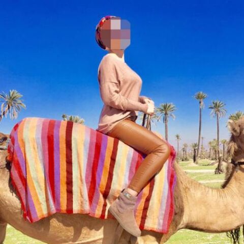 Η 34χρονη Ιωάννα που δέχθηκε επίθεση με βιτριόλι 