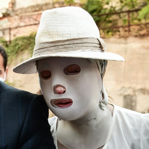 Η Ιωάννα Παλιοσπύρου στο δικαστήριο με την ειδική μάσκα - Ξεκίνησε η δική για την επίθεση με βιτριόλι στην Καλλιθέα