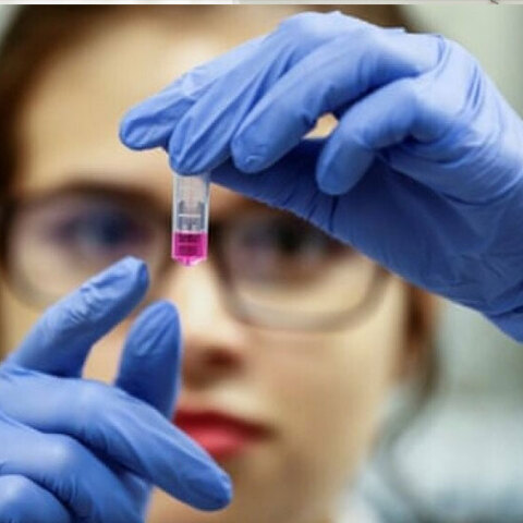 Υγειονομικός στο εργαστήριο κατά τη διάρκεια ελέγχου για τεστ αντισωμάτων για τον κορωνοϊό (ΦΩΤΟ ΑΡΧΕΙΟΥ)