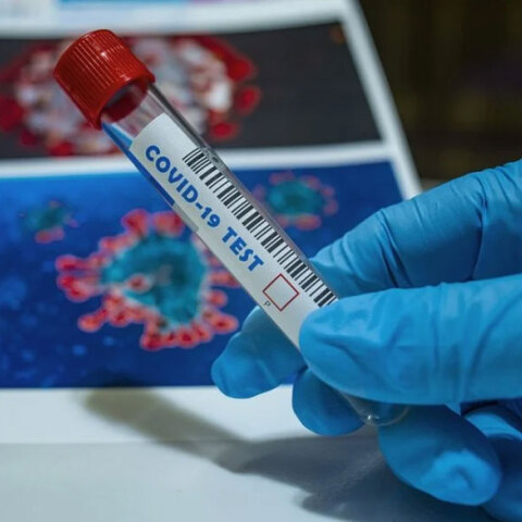 Πλαστικός σωλήνας σε εργαστήριο ανάλυσης για κορωνοϊό (ΦΩΤΟ ΑΡΧΕΙΟΥ) - Τα μονοκλωνικά αντισώματα δεν αποτελούν άμεση λύση για την πανδημία στην Ελλάδα, ξεκαθαρίζει ο Ηλίας Μόσιαλος