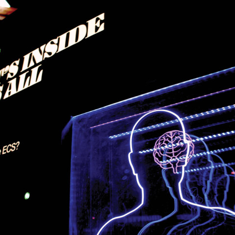 Aλτσχάιμερ: Η διατροφή ως προστατευτικός παράγοντας της νόσου  