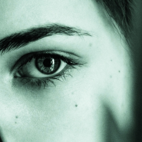 Βλεφαροπλαστική: Αναίμακτες και ανώδυνες οι σύγχρονες τεχνικές