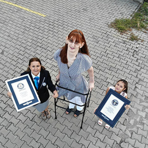 Η ψηλότερη γυναίκα στον κόσμο ονομάζεται Rumeysa Gelgi και ζει στην Τουρκία