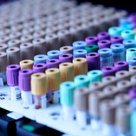 Κορωνοϊός: Έφτασαν στην Ελλάδα τα πρώτα μονοκλωνικά αντισώματα