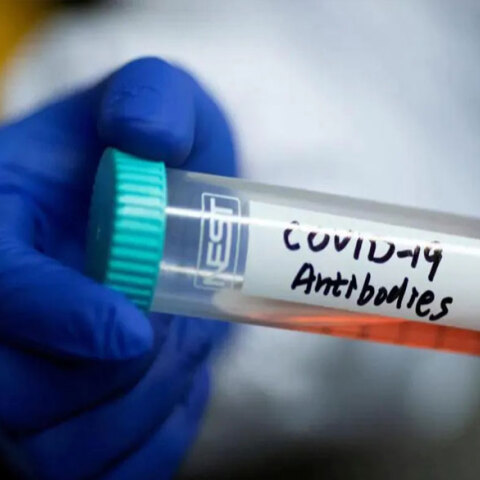 Μονοκλωνικά αντισώματα, η νέα θεραπεία για τον κορωνοϊό