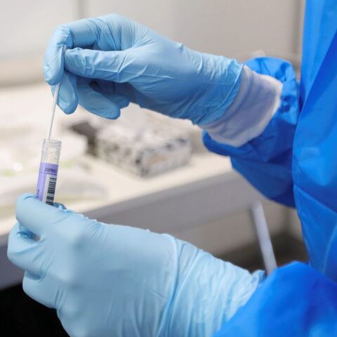 Θετικές στον κοροναϊό μοναχές της Ιεράς Μονής του Αγίου Νεκταρίου