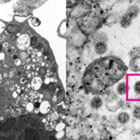 Όμικρον: Η πρώτη φωτογραφία από ηλεκτρονικό μικροσκόπιο