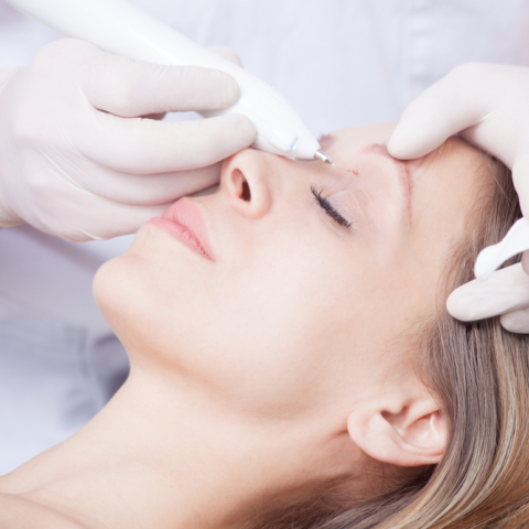 Πώς θα απαλλαγείτε από θηλώματα και ξανθελάσματα στα βλέφαρα;