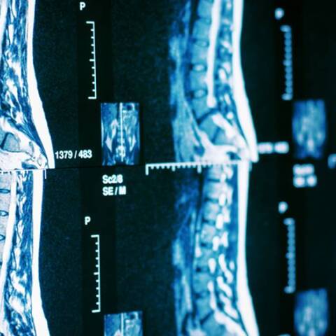 Εφαρμογή της ρομποτικής χειρουργικής της σπονδυλικής στήλης