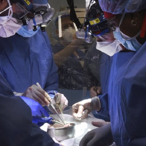 Έγινε η πρώτη μεταμόσχευση καρδιάς χοίρου σε άνθρωπο