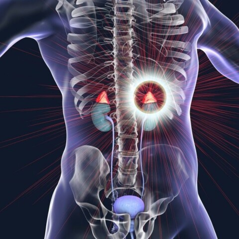 Καρκίνος του φλοιού των επινεφριδίων: Τι πρέπει να γνωρίζουμε