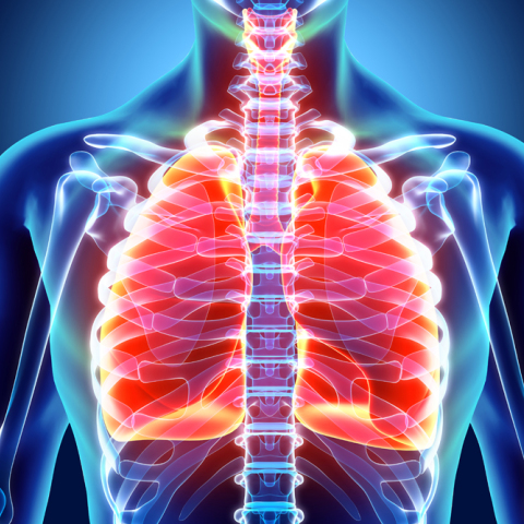 Καρκίνος του πνεύμονα: Ελάχιστα επεμβατική χειρουργική