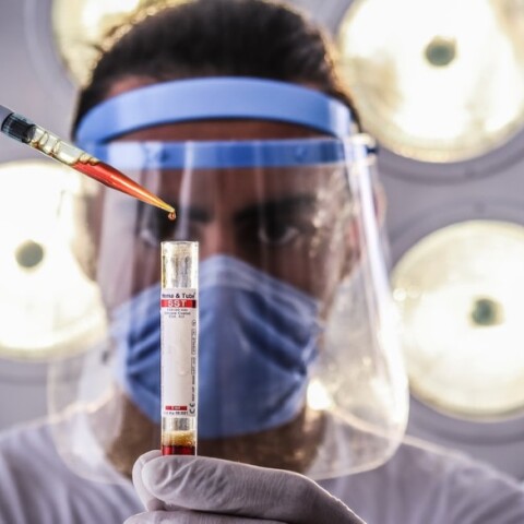 Υπό ανάπτυξη ένα απλό τεστ DNA που μπορεί να ανιχνεύσει ταυτόχρονα πολλές νευρολογικές παθήσεις με γενετική αιτιολογία