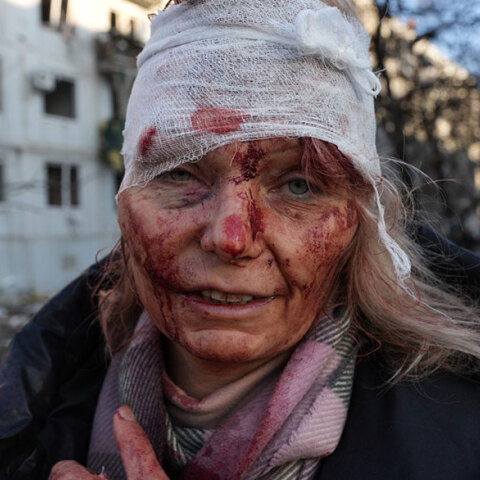 Η τραυματισμένη δασκάλα στην Ουκρανία έξω από το κατεστραμμένο σπίτι της στο Χάρκοβο