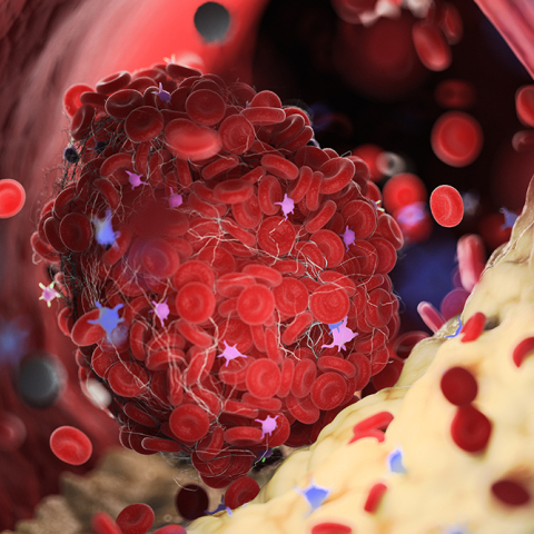 Πώς μπορεί να σώσει τη ζωή μας η διάγνωση των λιπιδίων