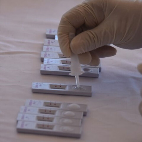 Δωρεάν rapid test από τον ΕΟΔΥ