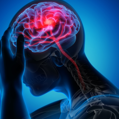 Βλάβες του εγκεφάλου: Αντιμετώπιση με ενδοαγγειακή χειρουργική 