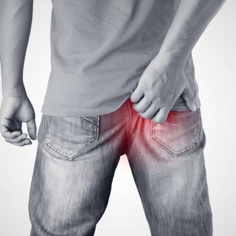 Βοηθάει η αποτρίχωση με λέιζερ στην κύστη κόκκυγα;