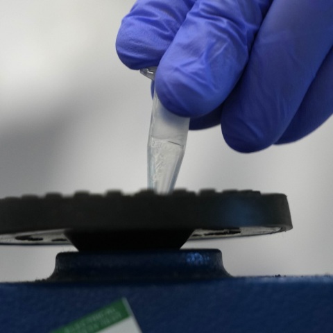 Έρευνα: Οι ανεμβολίαστοι που νοσούν με Όμικρον 2 δεν αναπτύσσουν αντισώματα έναντι άλλων παραλλαγών του κορονοϊού