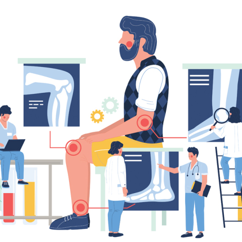 Απλά μια ασθένεια των αρθρώσεων η ρευματοειδής αρθρίτιδα;