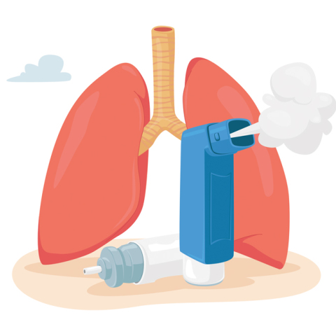 Συμπτώματα, τύποι και θεραπεία του βρογχικού άσθματος