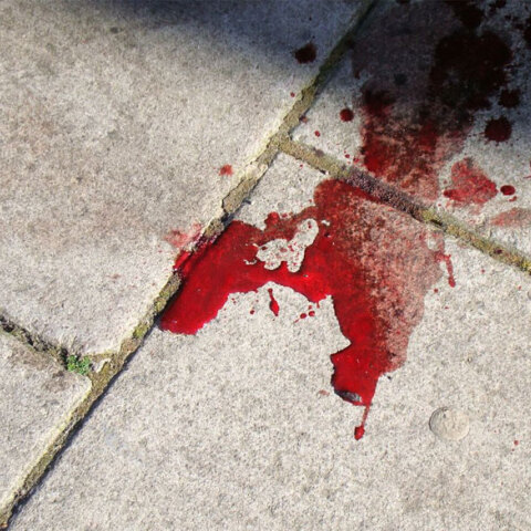 Στο κεφάλι με το αντικλεπτικό του τιμονιού χτύπησε 20χρονο ένας 55χρονος οδηγός στη Νέα Φιλαδέλφεια