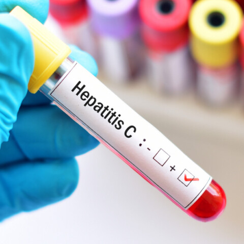 hepatitis-s.jpg
