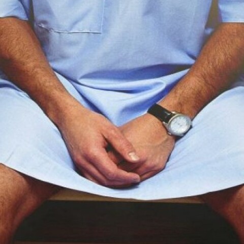 ανδρική στείρωση