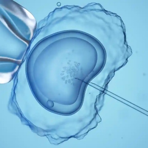 Δωρητής σπέρματος «έκρυβε» από λεσβίες το γενετικό σύνδρομό του που προκαλεί χαμηλό IQ και έκανε 15 παιδιά!