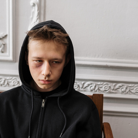 Έφηβος με μαύρο φούτερ και μελανιασμένα μάτια