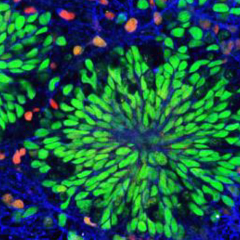 Νευρογένεση και Μνήμη