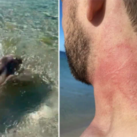 Αυστραλία: Το «πιο θυμωμένο χταπόδι» επιτίθεται σε τουρίστα 