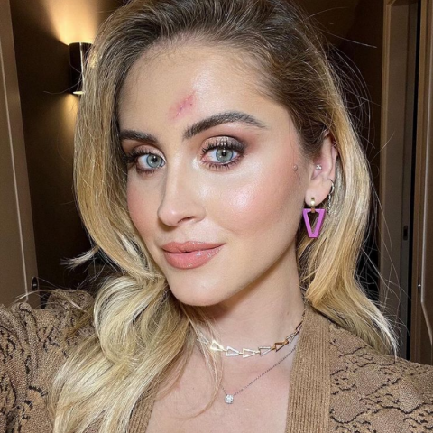 Η Valentina Ferragni με την ουλή στο πρόσωπο