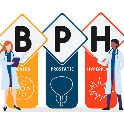 Καλοήθης υπερπλασία προστάτη: Νέα εποχή στην αντιμετώπισή της 