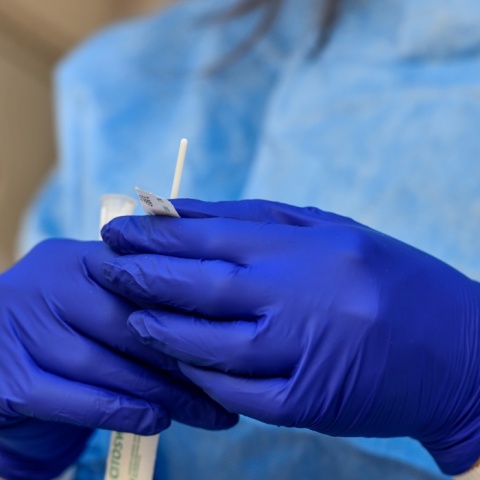 Δωρεάν rapid test από κλιμάκια του ΕΟΔΥ