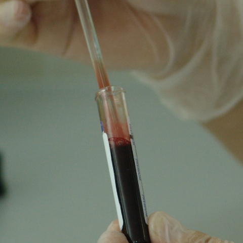 Φιαλίδιο με αιμα