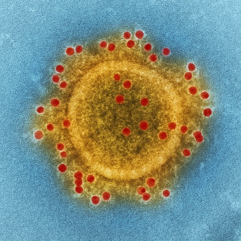 Η κλιματική αλλαγή επιδεινώνει πάνω από τις μισές μεταδοτικές ασθένειες στη Γη