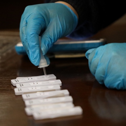 Δωρεάν rapid test από κλιμάκια του ΕΟΔΥ