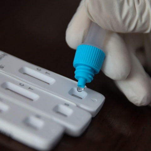 Δωρεάν rapid test από κλιμάκια του ΕΟΔΥ