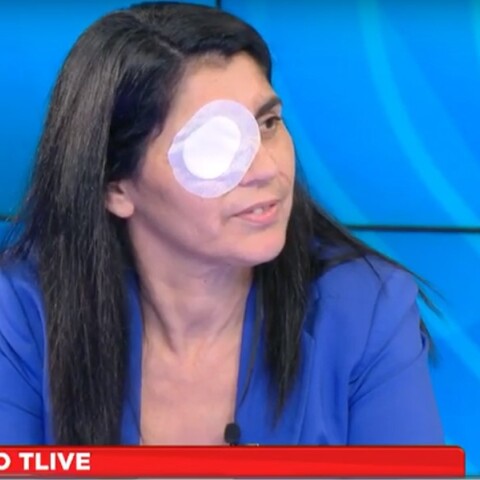 Η 49χρονη Χριστίνα, θύμα της επίθεσης με οξύ στη Μεσσήνη, με καλυμμένο το ένα της μάτι