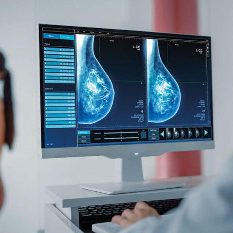 Μαστογραφικός έλεγχος στον όμιλο Affidea