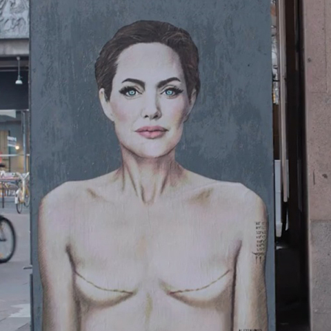 Αντζελίνα Τζολί: Το γκράφιτι του aleXsandro Palombo στην Ιταλία με ουλές μαστεκτομής και το μήνυμα για την πρόληψη του καρκίνου