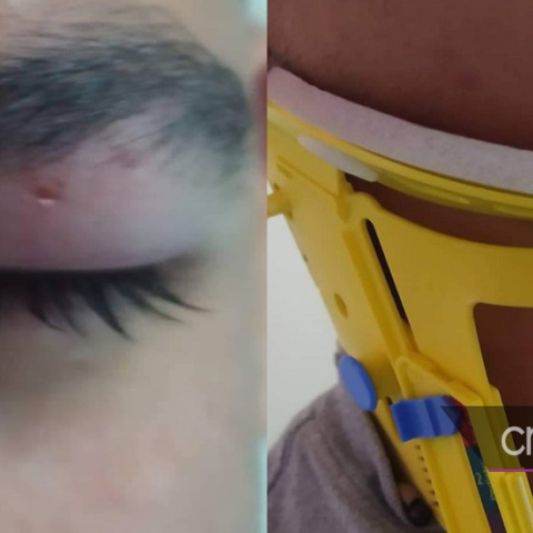 Στο νοσοκομείο μαθητής Λυκείου μετά τον ξυλοδαρμό του από οδηγό αυτοκινήτου