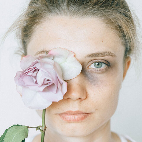 Κακοποιημένη γυναίκα με μελανιά στο μάτι