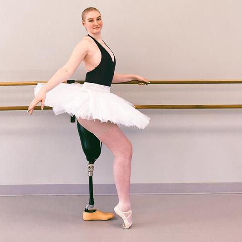 Kara Skrubis, η 21χρονη μπαλαρίνα που χορεύει με πρόσθετο πόδι μετά τον ακρωτηριασμό της