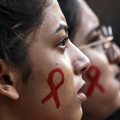 Η ανακοίνωση του Συλλόγου Οροθετικών Ελλάδας «Θετική Φωνή», με αφορμή την Παγκόσμια Ημέρα AIDS - Διεκδικήσεις και κατακτήσεις των οροθετικών στη χώρα μας το 2022.