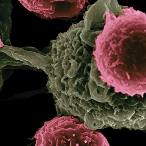 καρκίνος του πνεύμονα