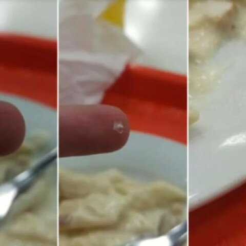 Γυαλί σε φαγητό φοιτητή στην Πάτρα